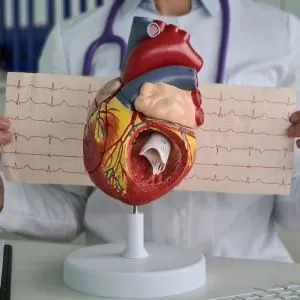 Examen Cardiológico: Electrocardiograma  - CardioSurPeru